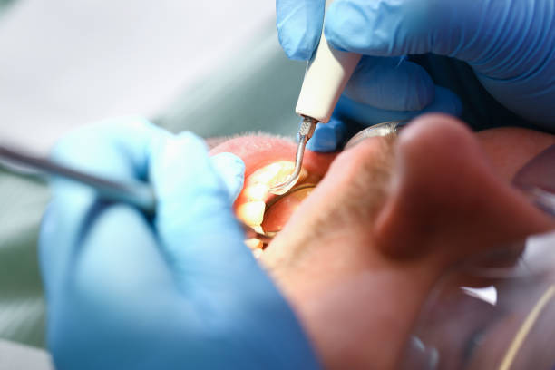 Best Emergency Treatment for Oral Infections in Barnhart, MO