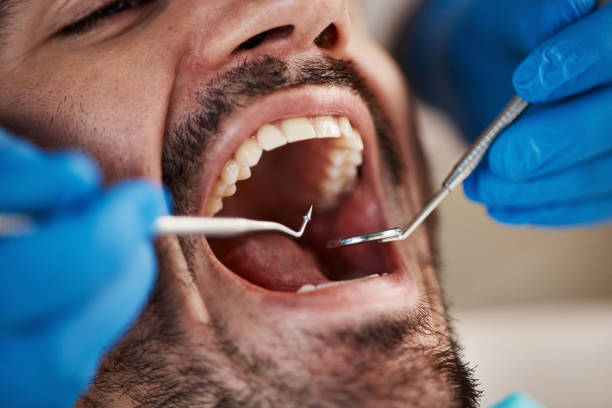 Best Broken or Chipped Tooth Repair in Barnhart, MO